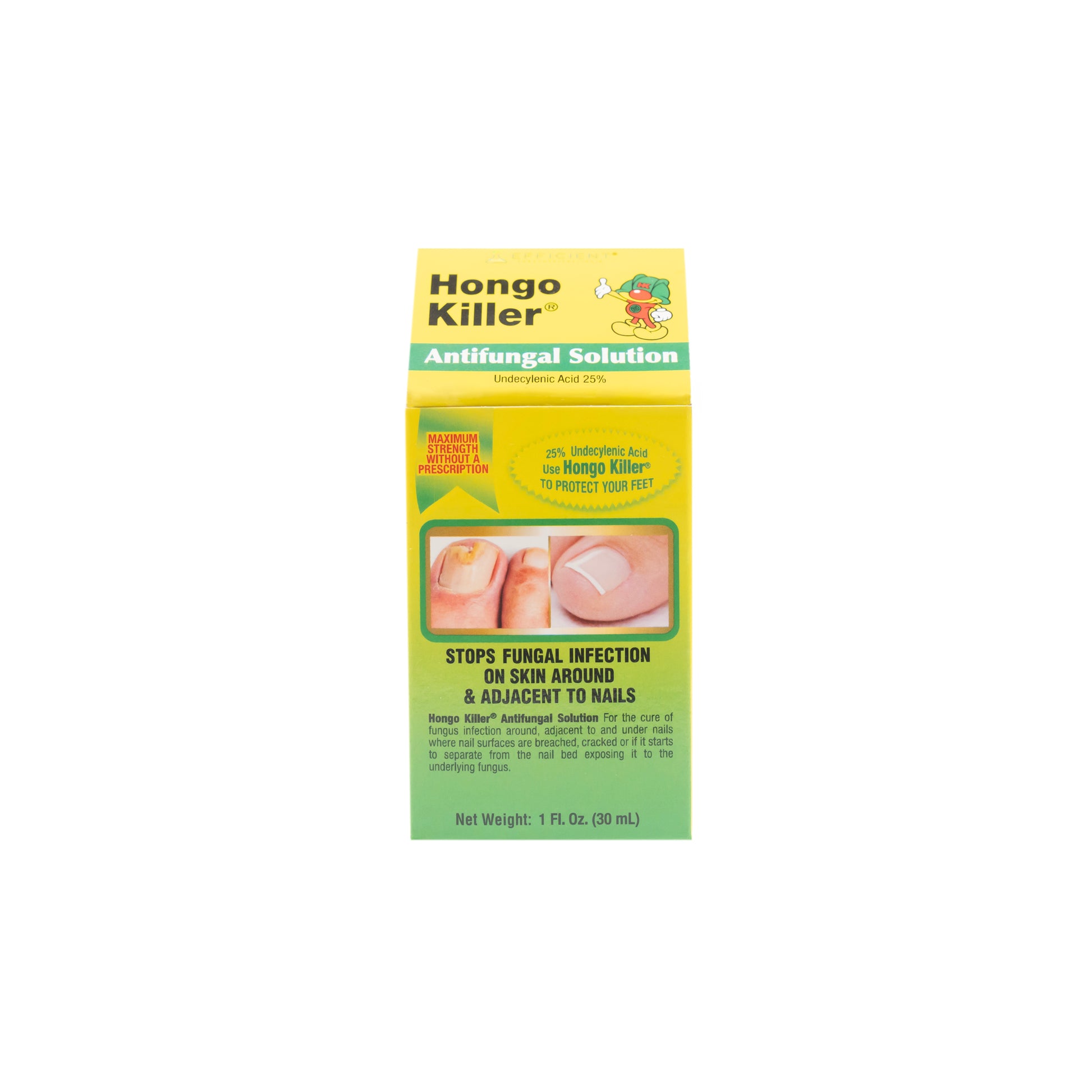 Hongo Killer Antifungal Solution 